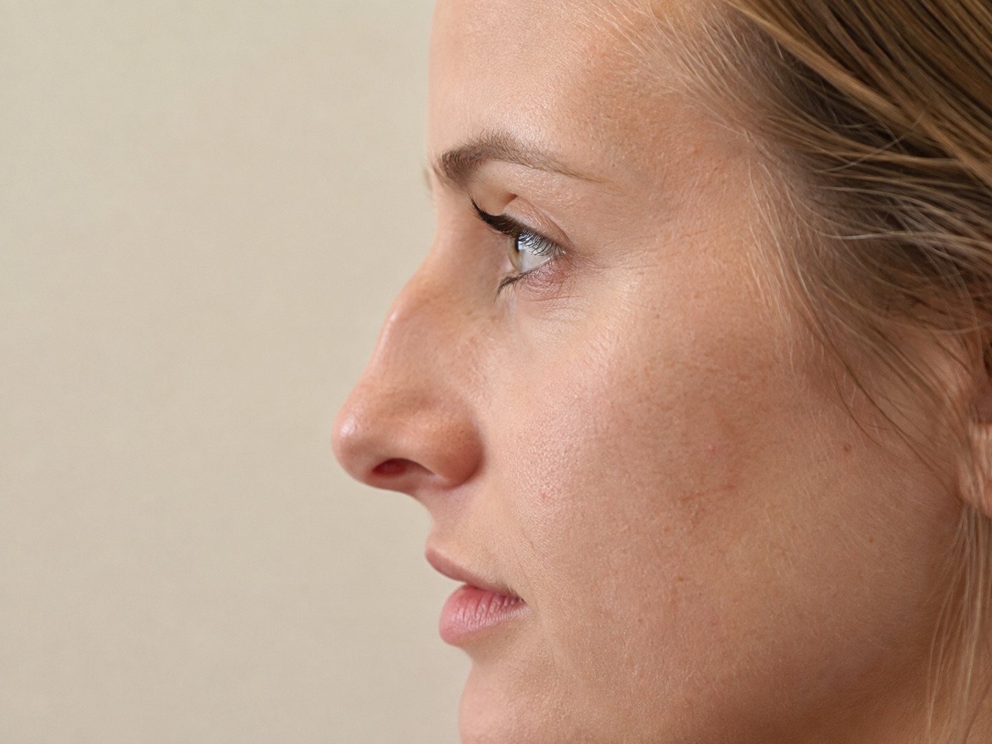 Close side profile of a woman showing a natural bump and dip along the nose bridge